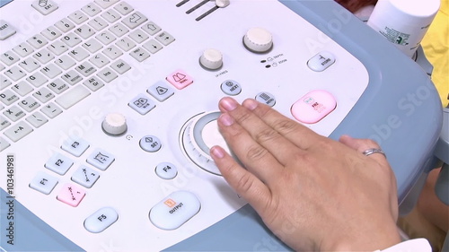 High quality ultrasound echography check. Gynecological medical examination