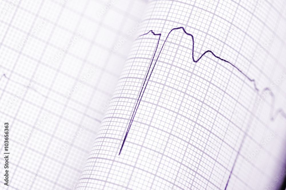 Folded graph paper with ECG Folded graph paper with ECG