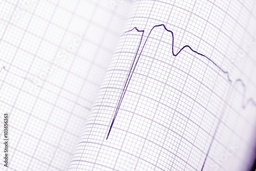 Folded graph paper with ECG