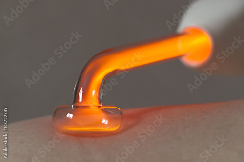 Medical procedure darsonvalization photo