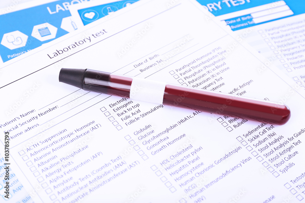 Blood in test tubes and investigation form on the table, close-up Blood in test tubes and investigation form on the table, close-up