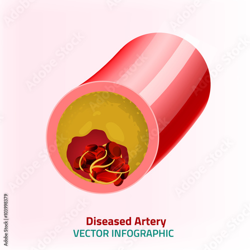 Blood Vector Image