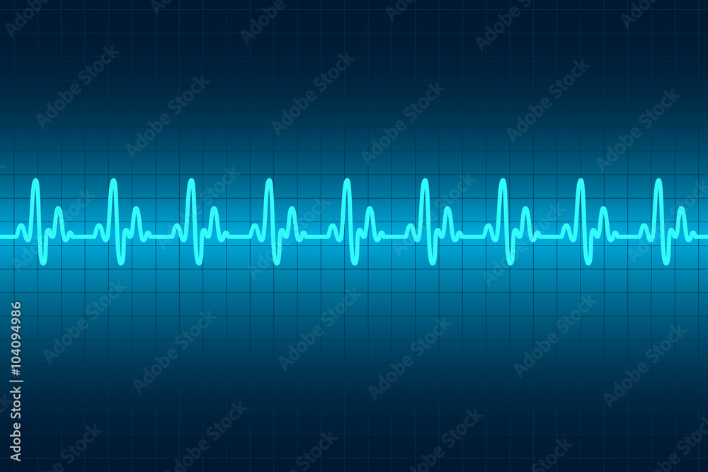 Heart cardiogram monitor. Rhythm heart.