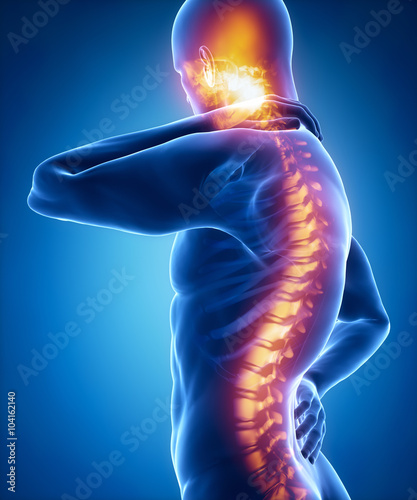 Spine injury pain in sacral and cervical region concept photo
