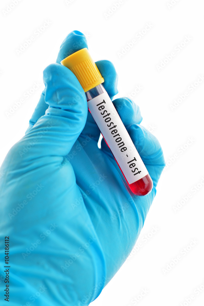 Obraz premium Blood sample for testosterone hormone test