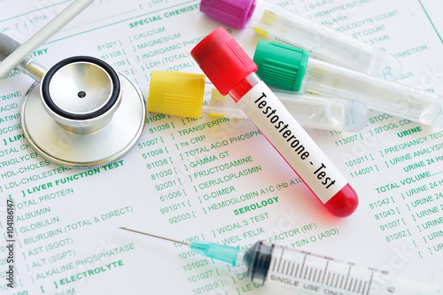 Fototapeta Blood sample for testosterone hormone test