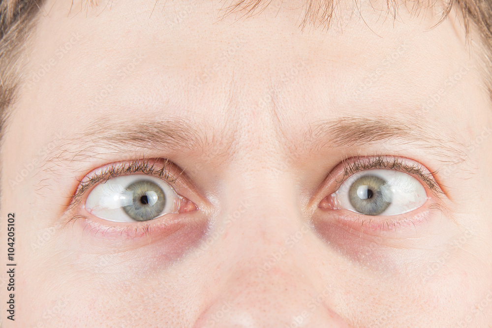 Obraz premium Man's crazy eyes