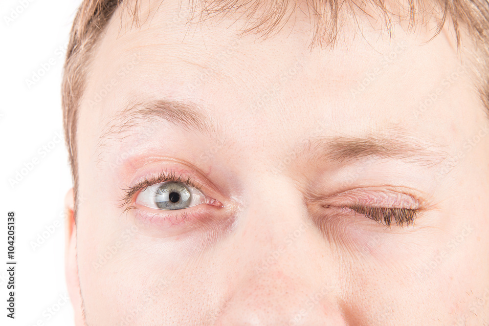 Obraz premium Man's tired eyes