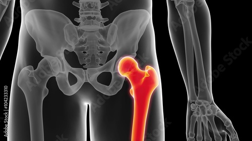 medical 3d animation of the femur bone photo