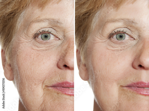 Foto before - after