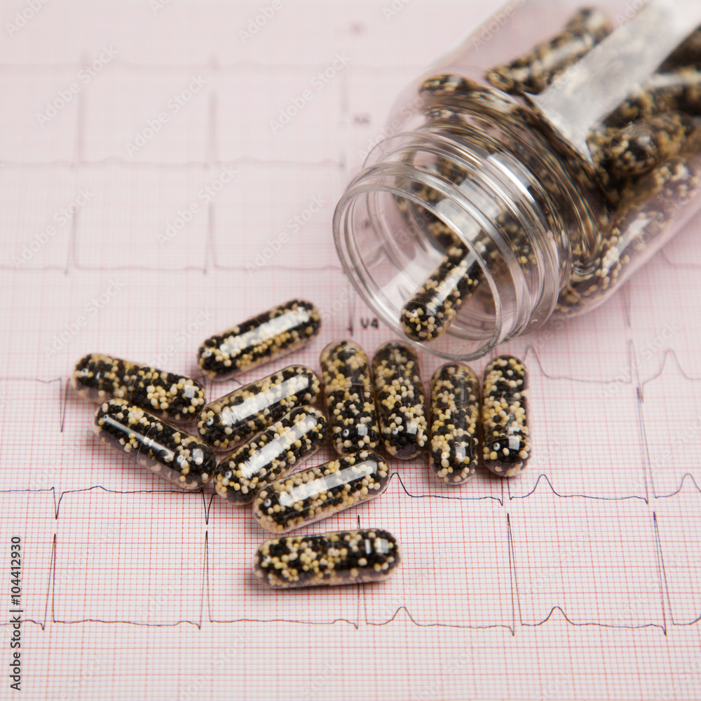 Medical report and cardiogram