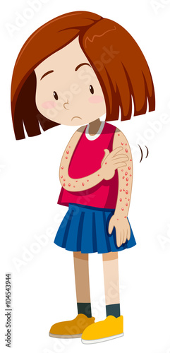 Girl having spots on her arms