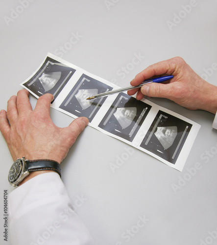 print on paper of inspection of ultrasonography