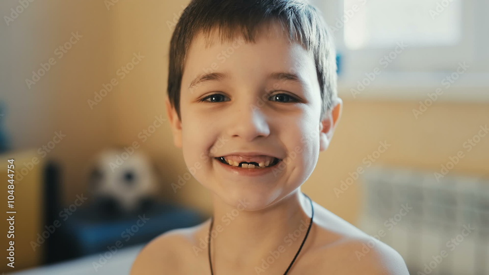 Close up of Happy Boy showing his Changing Teeth Close up of Happy Boy showing his Changing Teeth