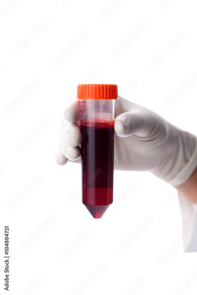 Hand holding a bottle of blood sample