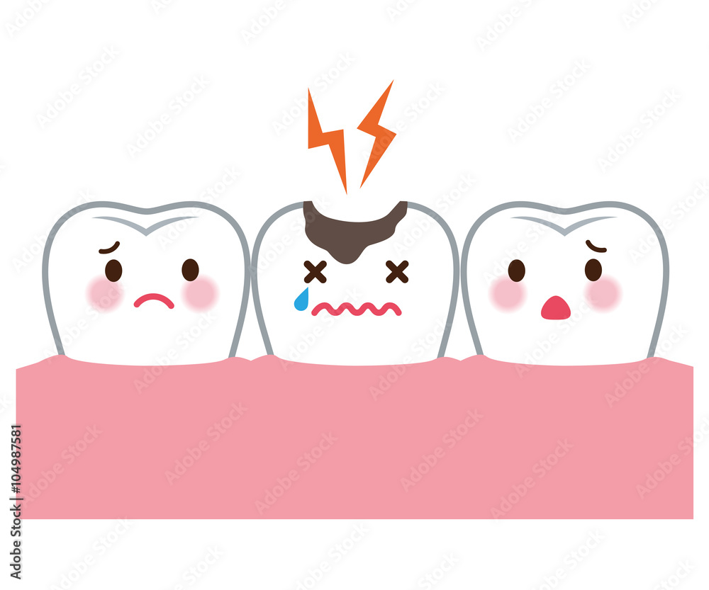 虫歯　歯　医療