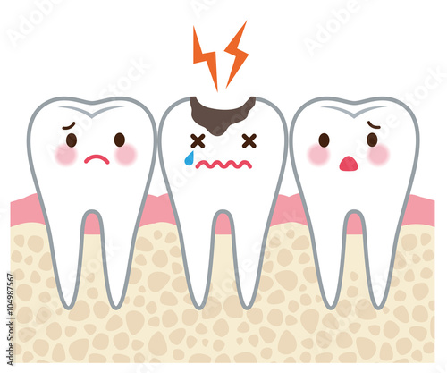 虫歯 歯 医療