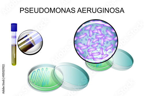Pseudomonas aeruginosa. bacterial inoculation photo