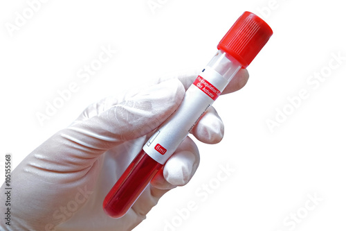 Pro-coagulation Clot Activator blood collection tube