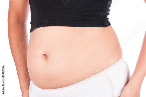 Women body with fat belly and stretch marks