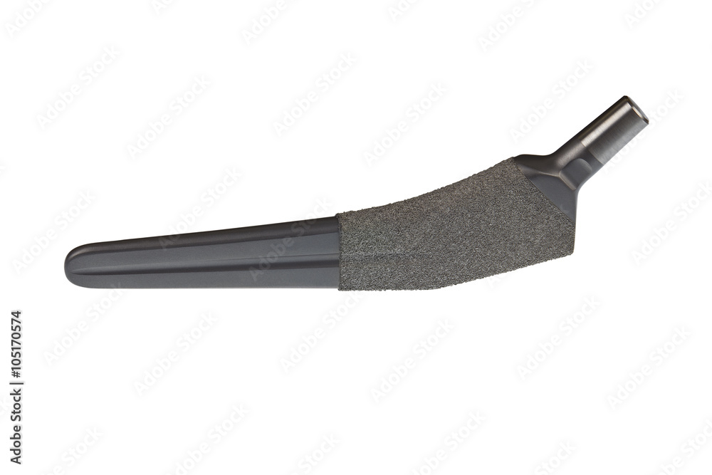 alloy hip alloy hip