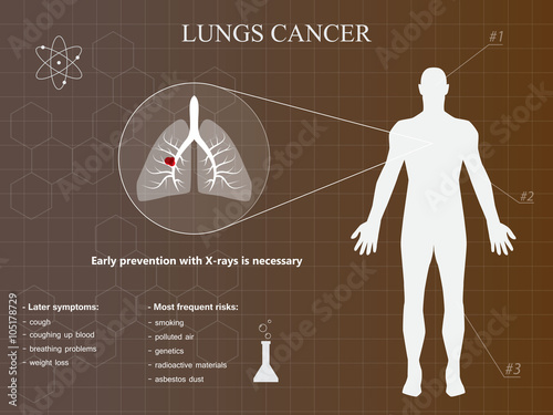 Lungs cancer infographic with brown background