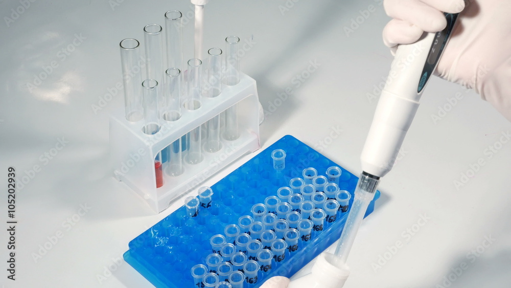 Lab technician scientist performs medical clinic chemical analysis and diagnostics using test tube phial and pipette. 4K UHD video footage. Lab technician scientist performs medical clinic chemical analysis and diagnostics using test tube phial and pipette. 4K UHD video footage.