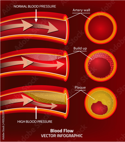 Blood Vector Image