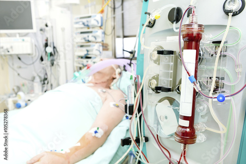 Patient on hemodialisis in intensive care unit photo