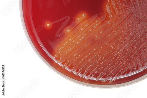 Streptococcus bacterial colonies with beta hemolytic on blood agar plate on white background, close-up.