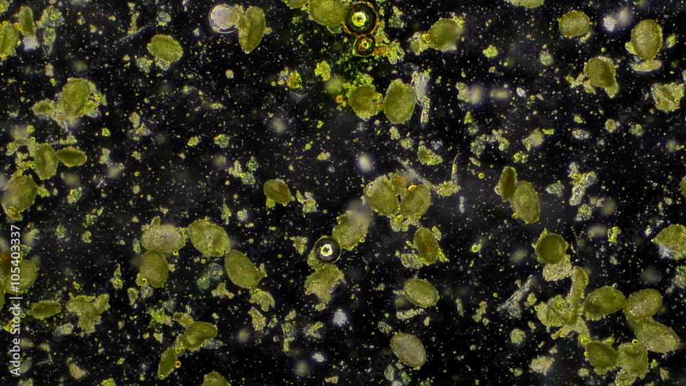 Pollen From Lily Flower Sample in Microscope 50x Pollen From Lily Flower Sample in Microscope 50x