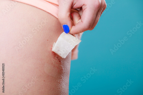 Human sticking plaster adhesive bandage to wound. photo