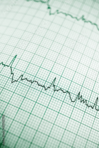 Electrocardiogram