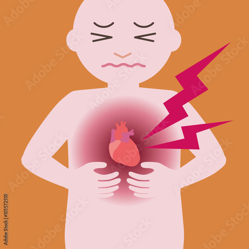 heart infarction, cardiac infarction, myocardial infarct, image illustration