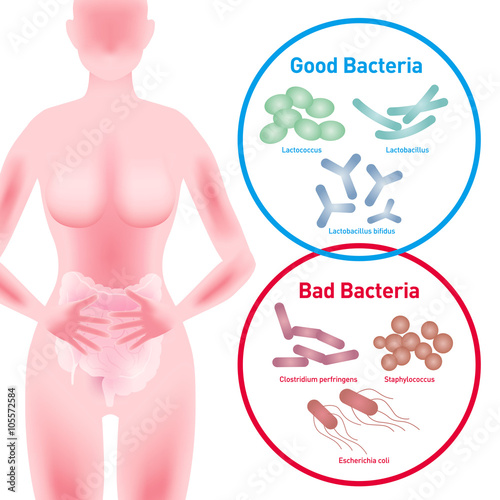 Woman silhouette and Good Bacteria and Bad Bacteria, enteric bacteria, Intestinal flora, Gut flora, probiotics, image illustration photo