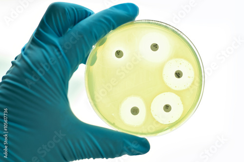 Antimicrobial susceptibility testing in petri dish
 photo