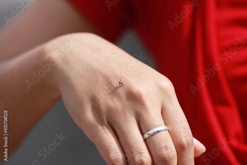 mosquito biting woman's hand