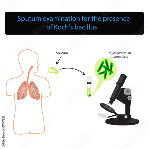 Sputum examination. World Tuberculosis Day. Infographics. Vector illustration on isolated background photo