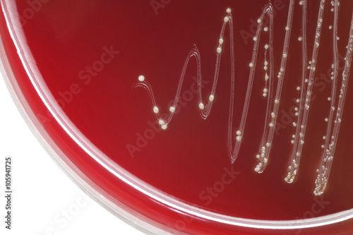 Streptococcus bacterial colonies with alpha hemolytic on blood a