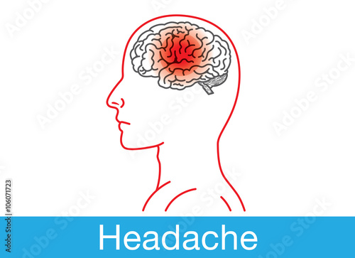 Side view of human brain have a red point sign on brain area which meaning headache