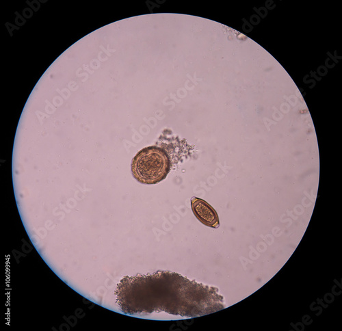 egg parasite photo