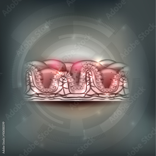 Celiac disease affected small intestine villi. Damaged cells by body's reaction to gluten. Intestinal villi do not absorb nutrients because of reduced surface area. Abstract grey background.