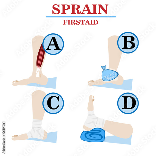 Sprain firstaid vector infographic image