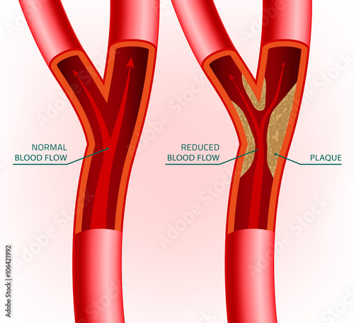 Blood Vein Image