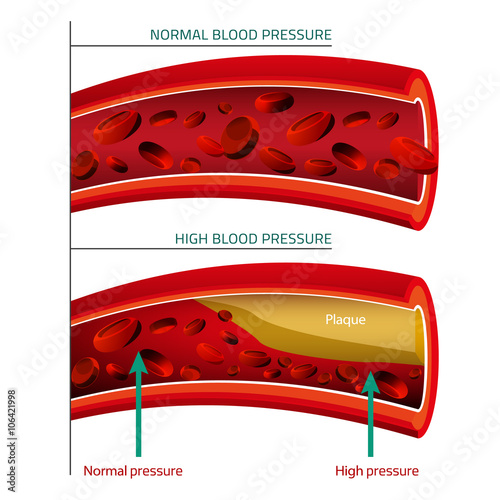 Blood Vector Image
