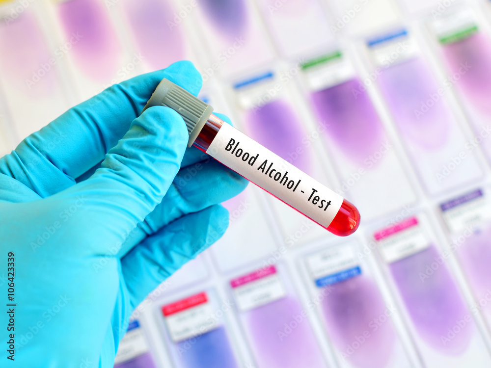 Fototapeta premium Blood sample for alcohol test