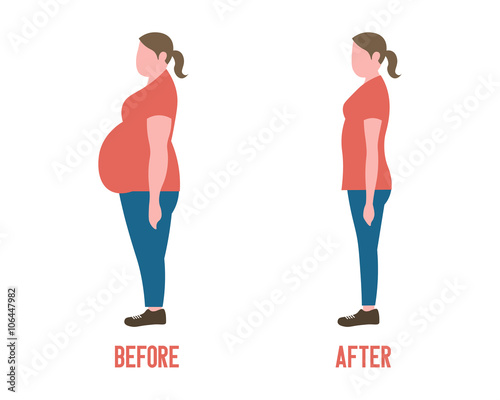 Body shape women before and after weight loss