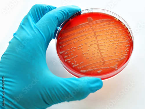 Colonies of bacteria in culture medium plate
 photo