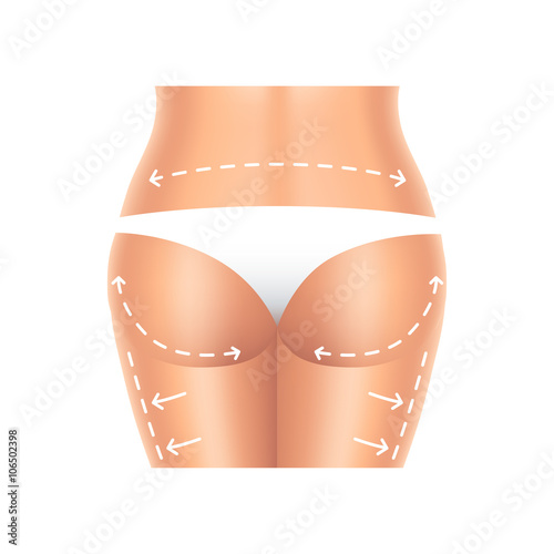 Plastic surgery buttocks and legs isolated vector