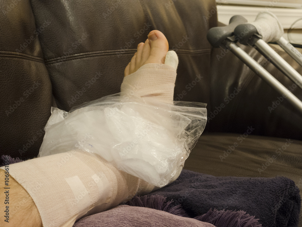 Sprained Ankle Icing and Elevated on Couch With Crutches in